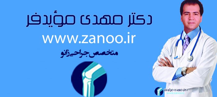 دکتر مهدی مویدفر متخصص جراحی زانو،جراحی زانو،بهترین متخصص ارتوپدی در اصفهان،بیماری های زانو_بهترین متخصص زانو در ایران،بهترین متخصص زانو در اصفهان،بهترین متخصص ارتوپدی در ایران،جراحی های زانو،بازسازی Acl زانو،بازسازی رباط های زانو،تعویض مفصل زانو،آرتروپلاستی زانوجراحی زانو